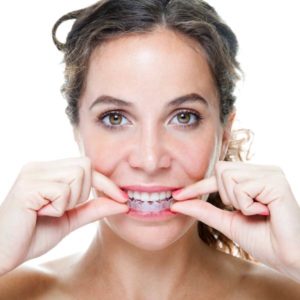 woman putting in Invisalign liner